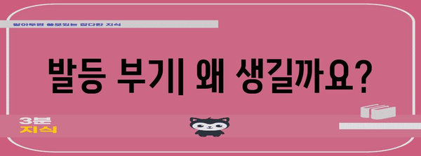 발등 부기 | 증상, 원인, 치료 및 예방